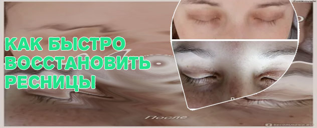 Как восстановить ресниц после наращивания