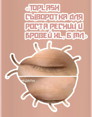 Toplash сыворотка отзывы реальные